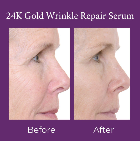 24K Gold Caviar Wrinkle Repair Serum